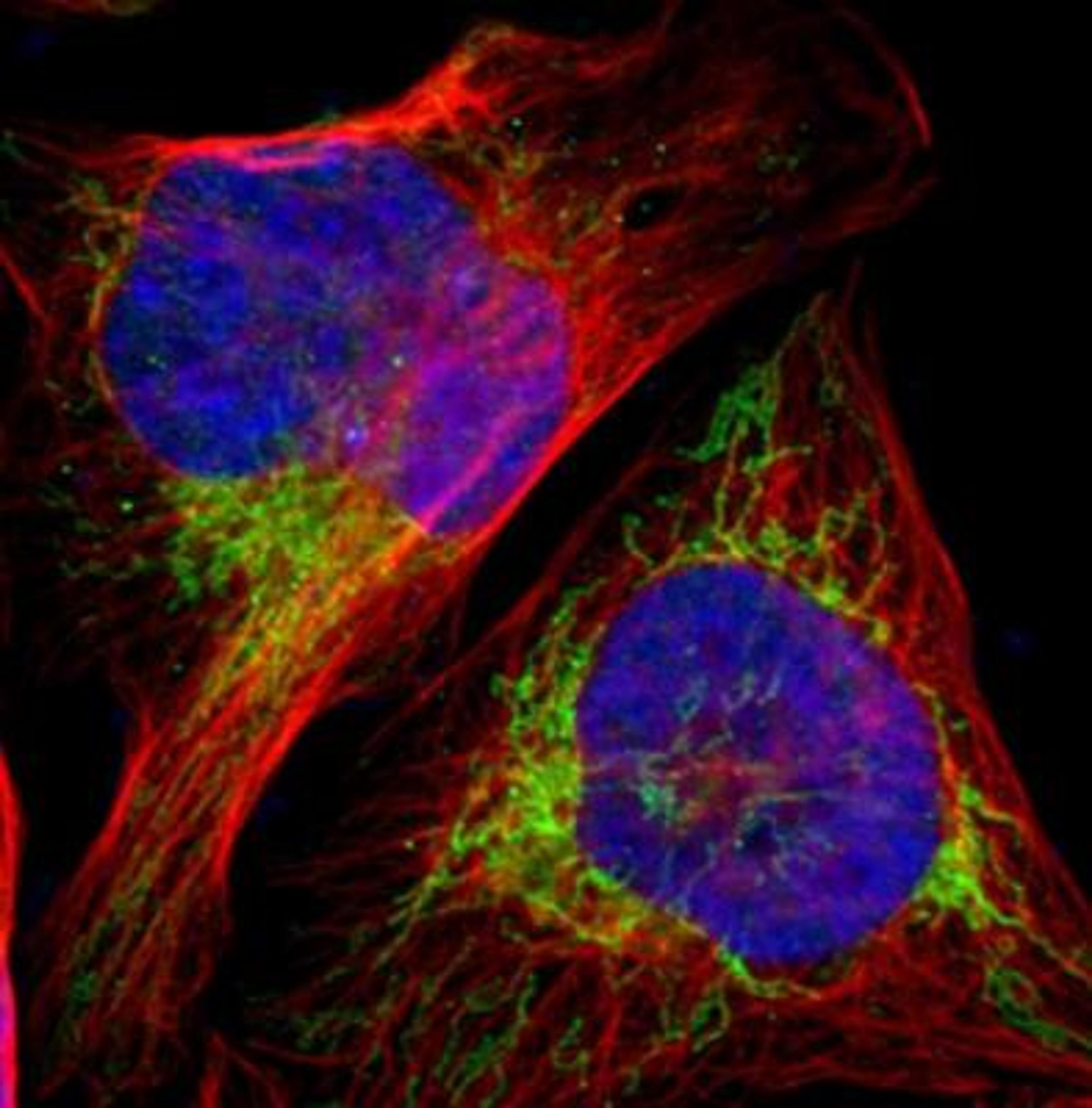 Immunocytochemistry/Immunofluorescence: HSD17B2 Antibody [NBP1-92011] - Human cell line.