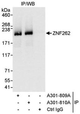 Detection of human ZNF262 by western blot of immunoprecipitates.