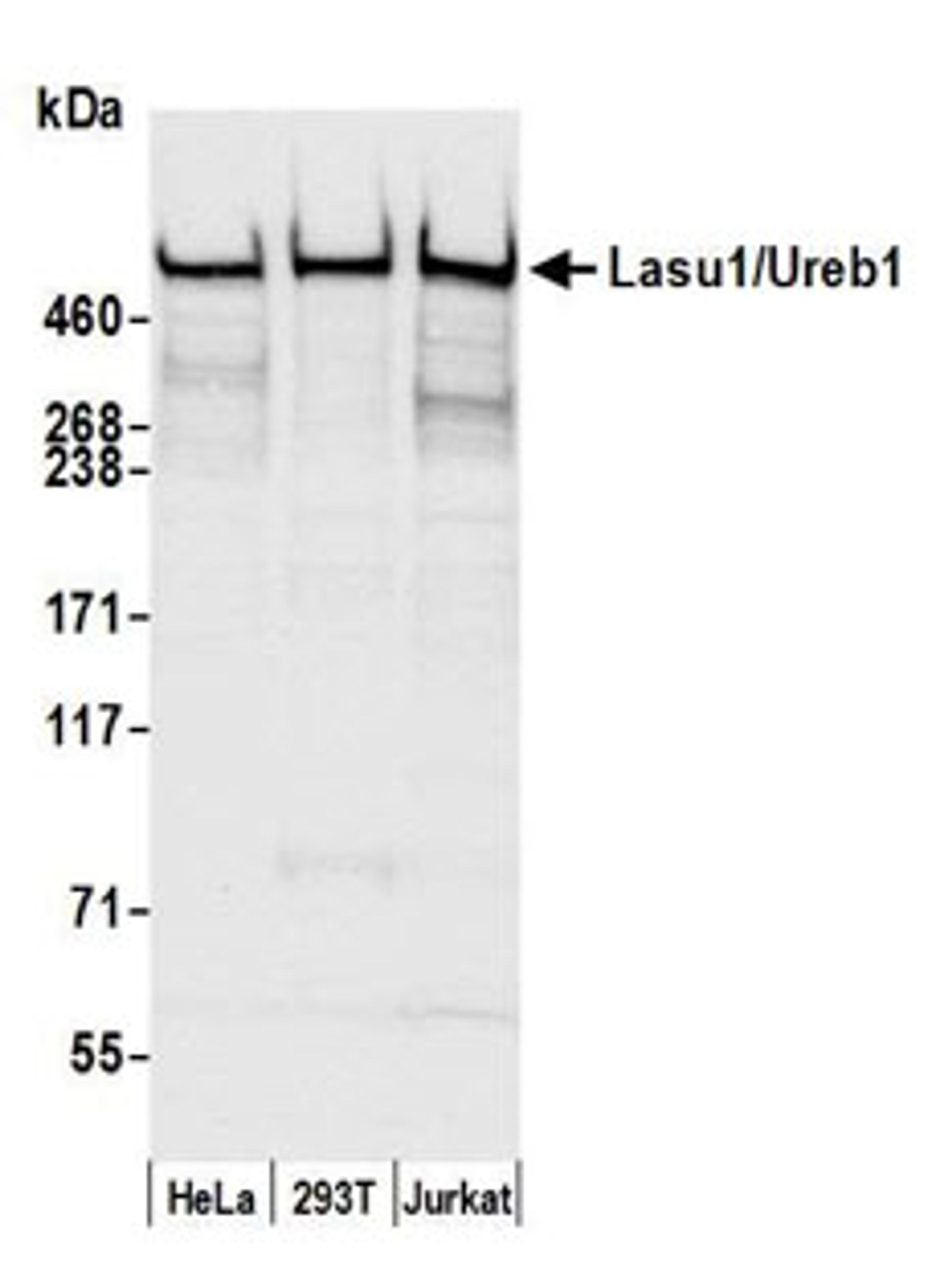 Detection of human Lasu1/Ureb1 by western blot.