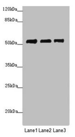 Western blot. All lanes: PRPF4 antibody at 3.89 ug/ml. Lane 1: Jurkat whole cell lysate. Lane 2: Hela whole cell lysate. Lane 3: HepG2 whole cell lysate. Secondary. Goat polyclonal to rabbit IgG at 1/10000 dilution. Predicted band size: 58 kDa. Observed band size: 58 kDa. 