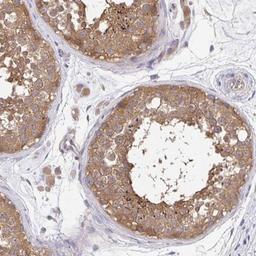 Immunohistochemistry: FEM1C Antibody [NBP2-32501] - Staining of human testis shows moderate cytoplasmic positivity in cells in seminiferous ducts and Leydig cells.