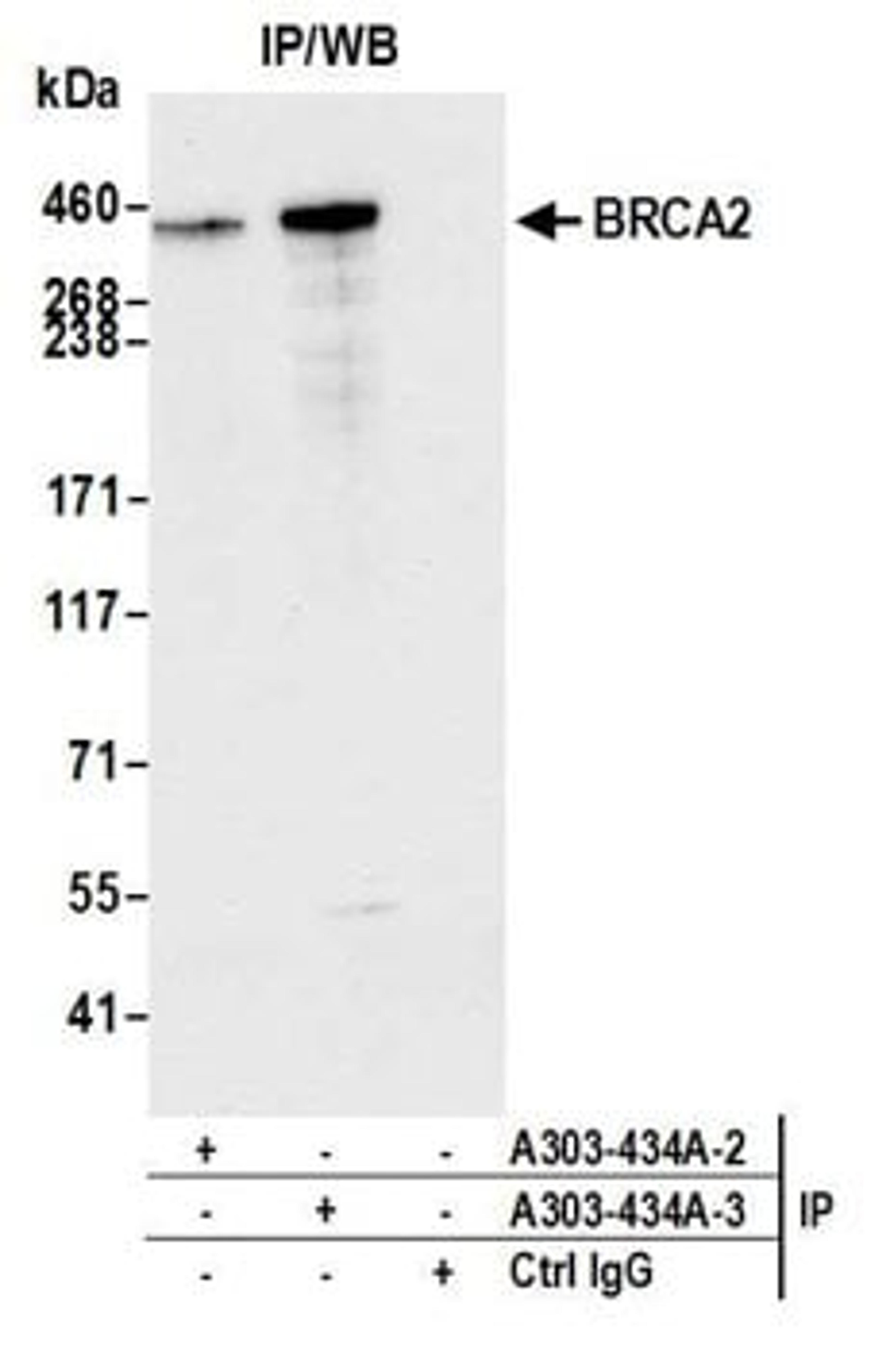 Detection of human BRCA2 by western blot of immunoprecipitates.