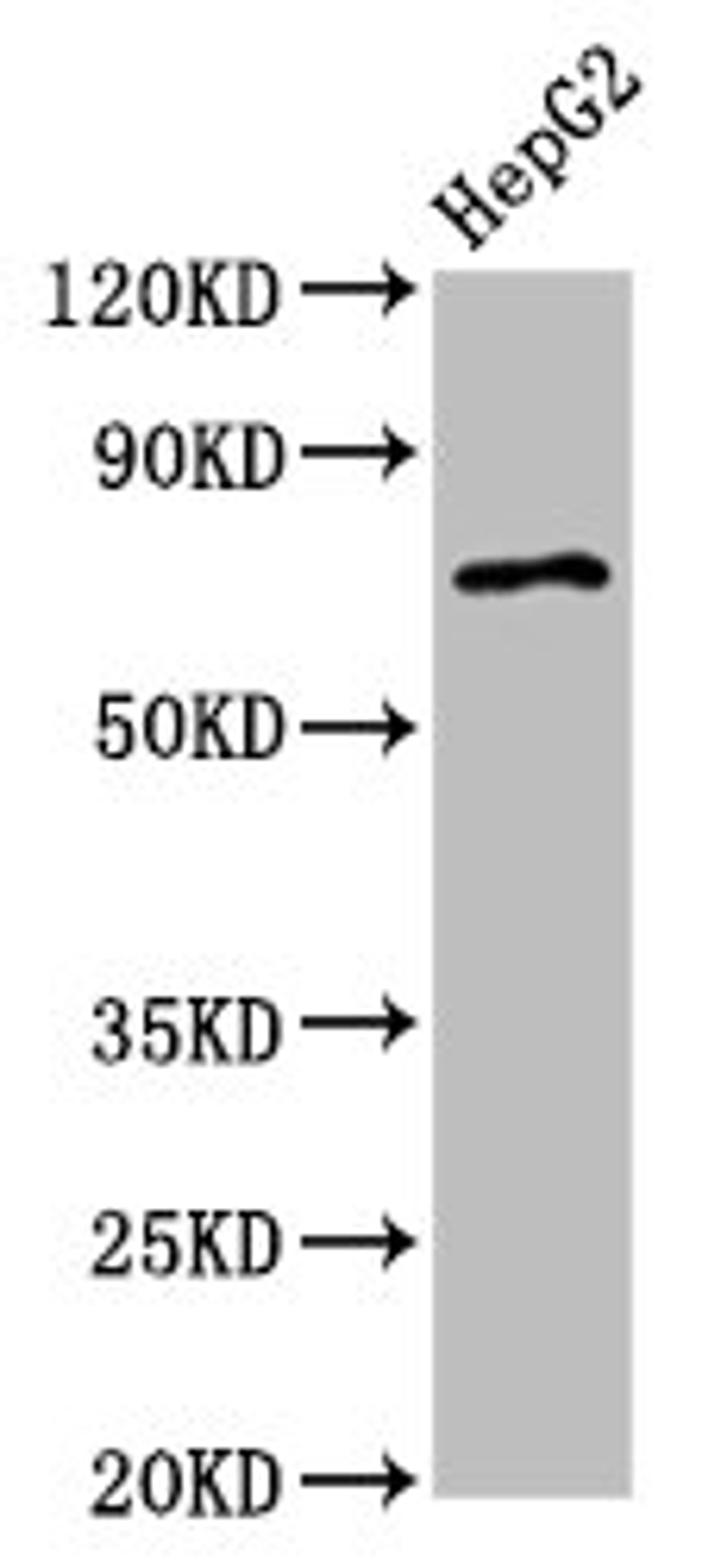 Western Blot. Positive WB detected in: HepG2 whole cell lysate. All lanes: AGPS antibody at 2.7µg/ml. Secondary. Goat polyclonal to rabbit IgG at 1/50000 dilution. Predicted band size: 73 kDa. Observed band size: 73 kDa