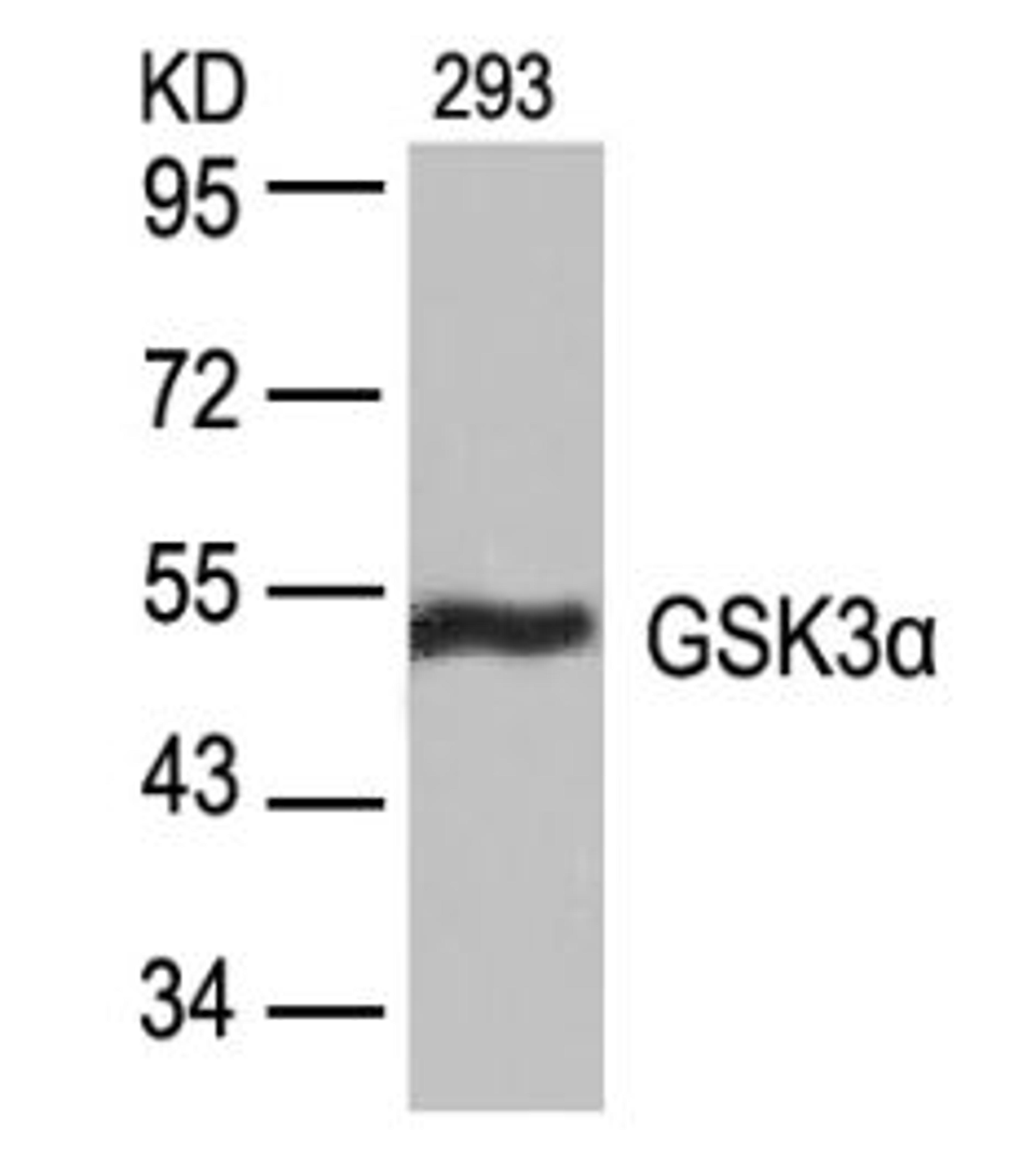 Western blot analysis of lysed extracts from 293 cells using GSK3&#945; (Ab-21).