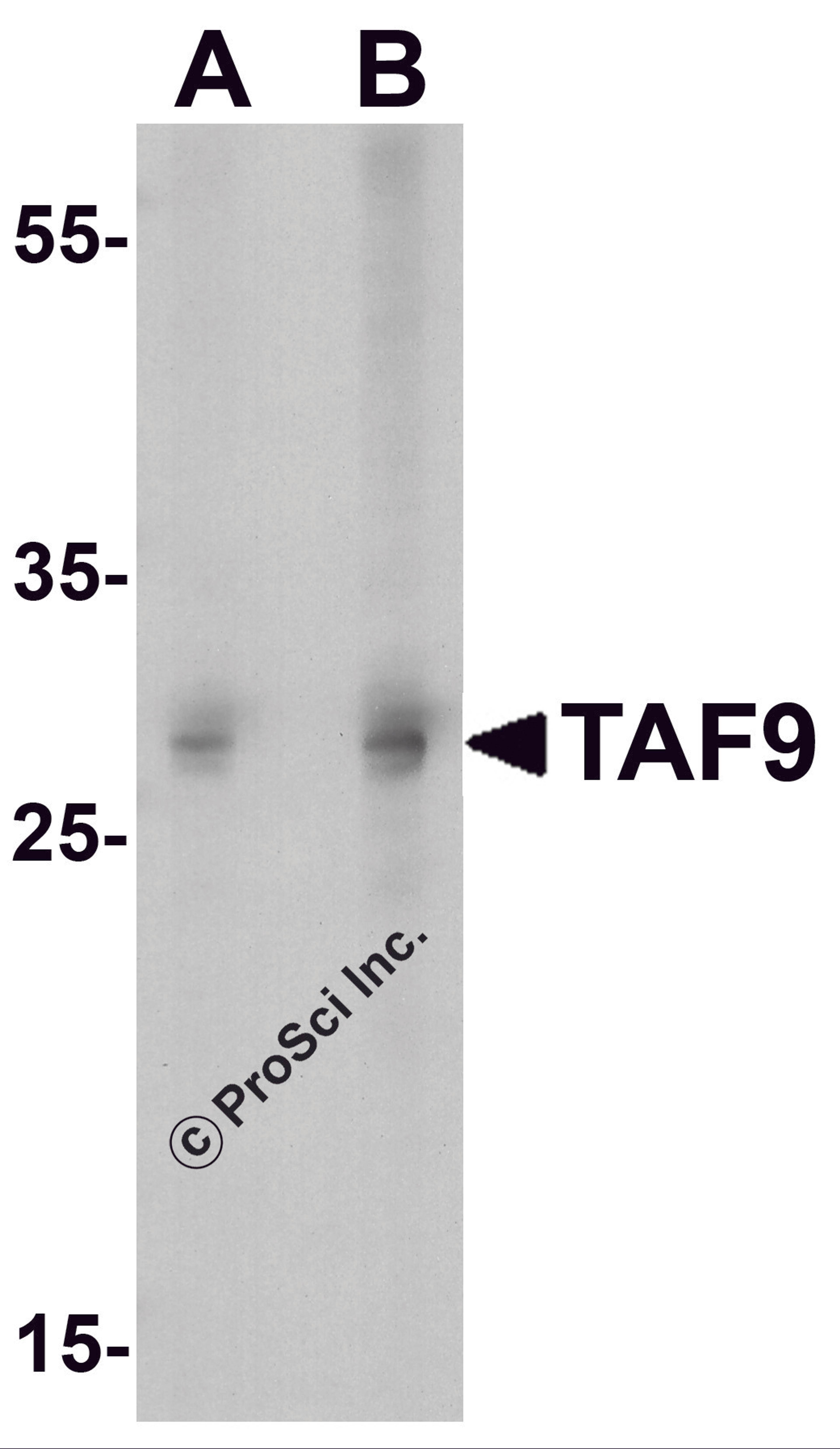 Western blot analysis of TAF9 in HepG2 cell lysate with TAF9 antibody at (A) 1 and (B) 2μg/ml.