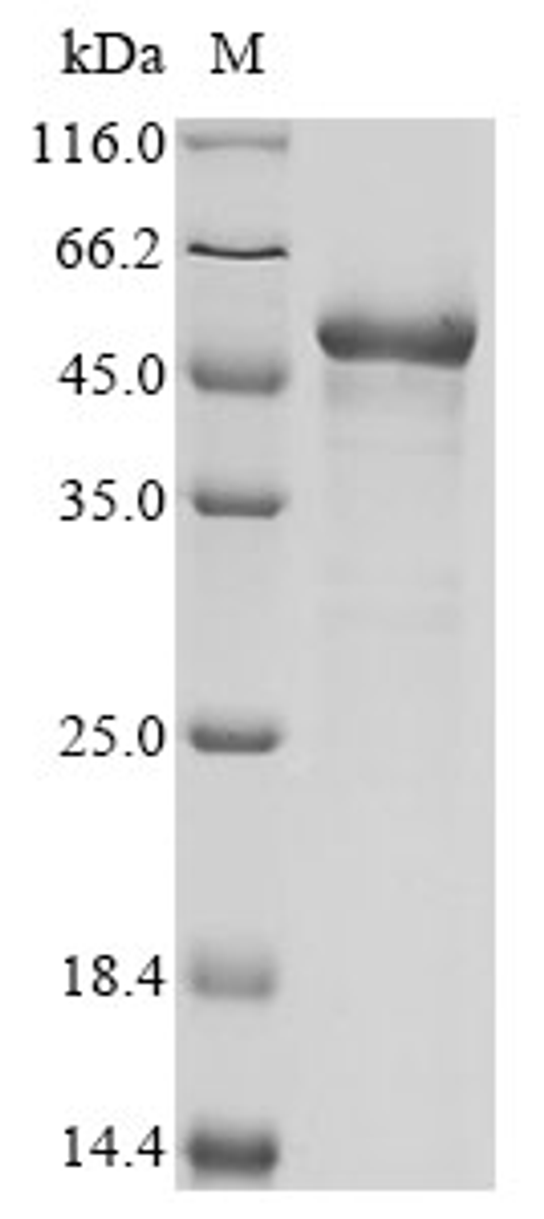 (Tris-Glycine gel) Discontinuous SDS-PAGE (reduced) with 5% enrichment gel and 15% separation gel.