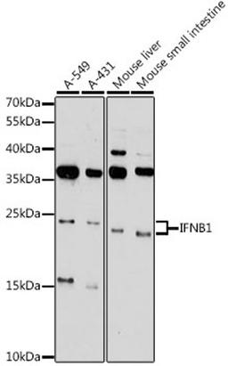 Western blot - IFNB1 antibody (A16223)