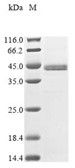 (Tris-Glycine gel) Discontinuous SDS-PAGE (reduced) with 5% enrichment gel and 15% separation gel.