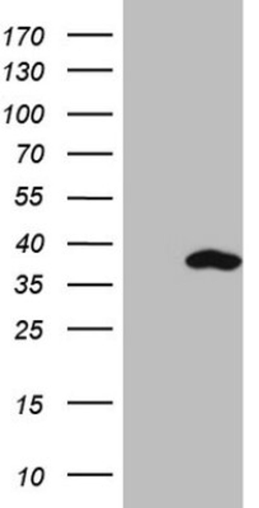 Western Blot: SNRPB2 Antibody (2A5) [NBP2-45893] - Analysis of HEK293T cells were transfected with the pCMV6-ENTRY control (Left lane) or pCMV6-ENTRY SNRPB2.