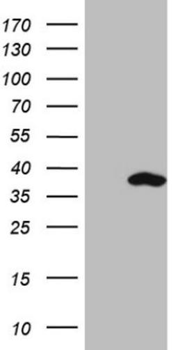 Western Blot: SNRPB2 Antibody (2A5) [NBP2-45893] - Analysis of HEK293T cells were transfected with the pCMV6-ENTRY control (Left lane) or pCMV6-ENTRY SNRPB2.