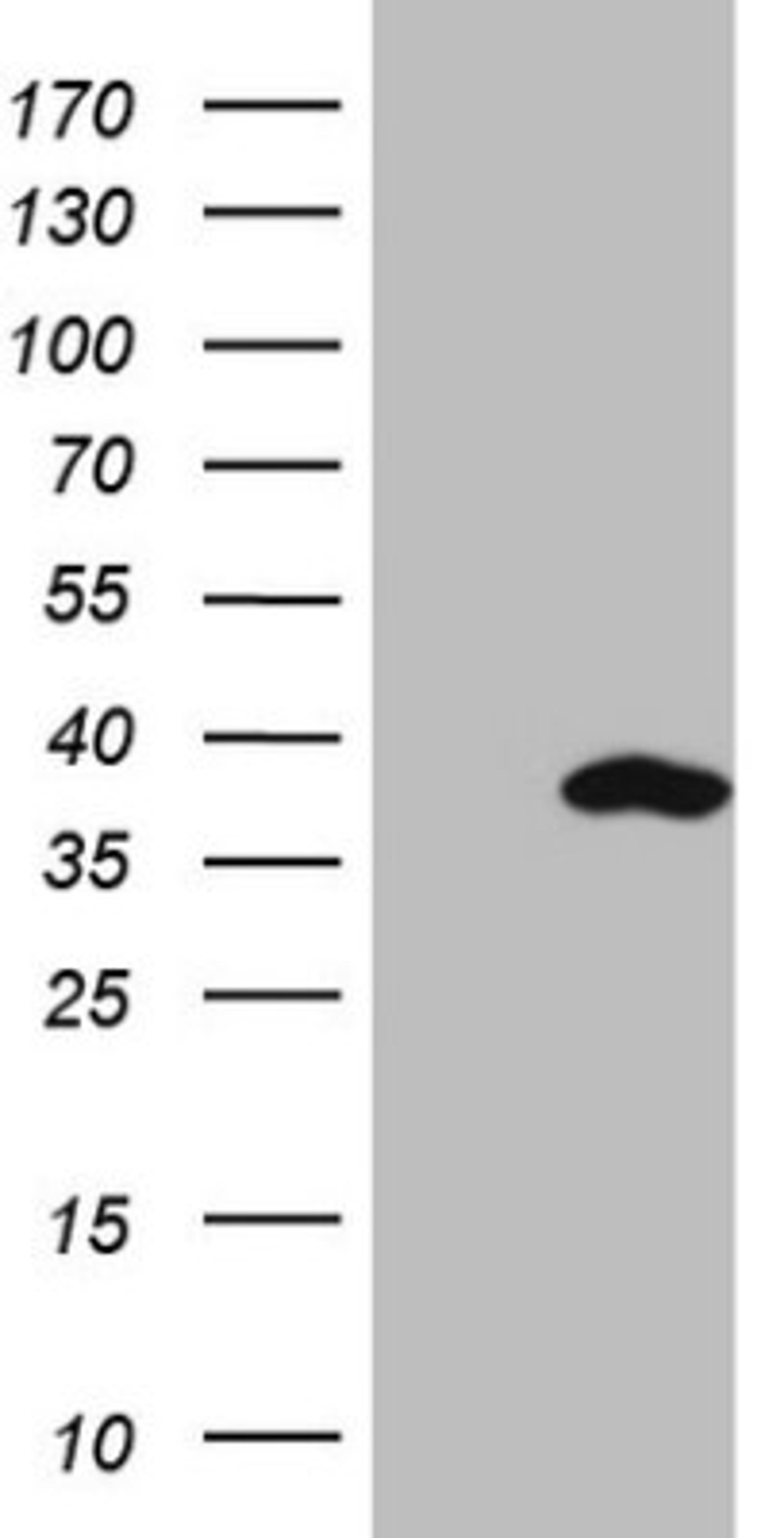 Western Blot: SNRPB2 Antibody (2A5) [NBP2-45893] - Analysis of HEK293T cells were transfected with the pCMV6-ENTRY control (Left lane) or pCMV6-ENTRY SNRPB2.