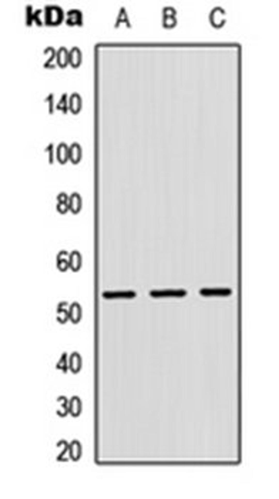 Western blot analysis of HEK293T (Lane 1), Raw264.7 (Lane 2), H9C2 (Lane 3) whole cell lysates using Cathepsin F antibody