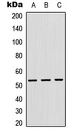 Western blot analysis of HEK293T (Lane 1), Raw264.7 (Lane 2), H9C2 (Lane 3) whole cell lysates using Cathepsin F antibody