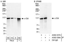 Detection of human c-Cbl by western blot and immunoprecipitation.