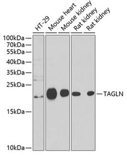 Western blot - TAGLN antibody (A6760)