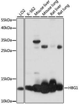 Western blot - HBG1 antibody (A14989)