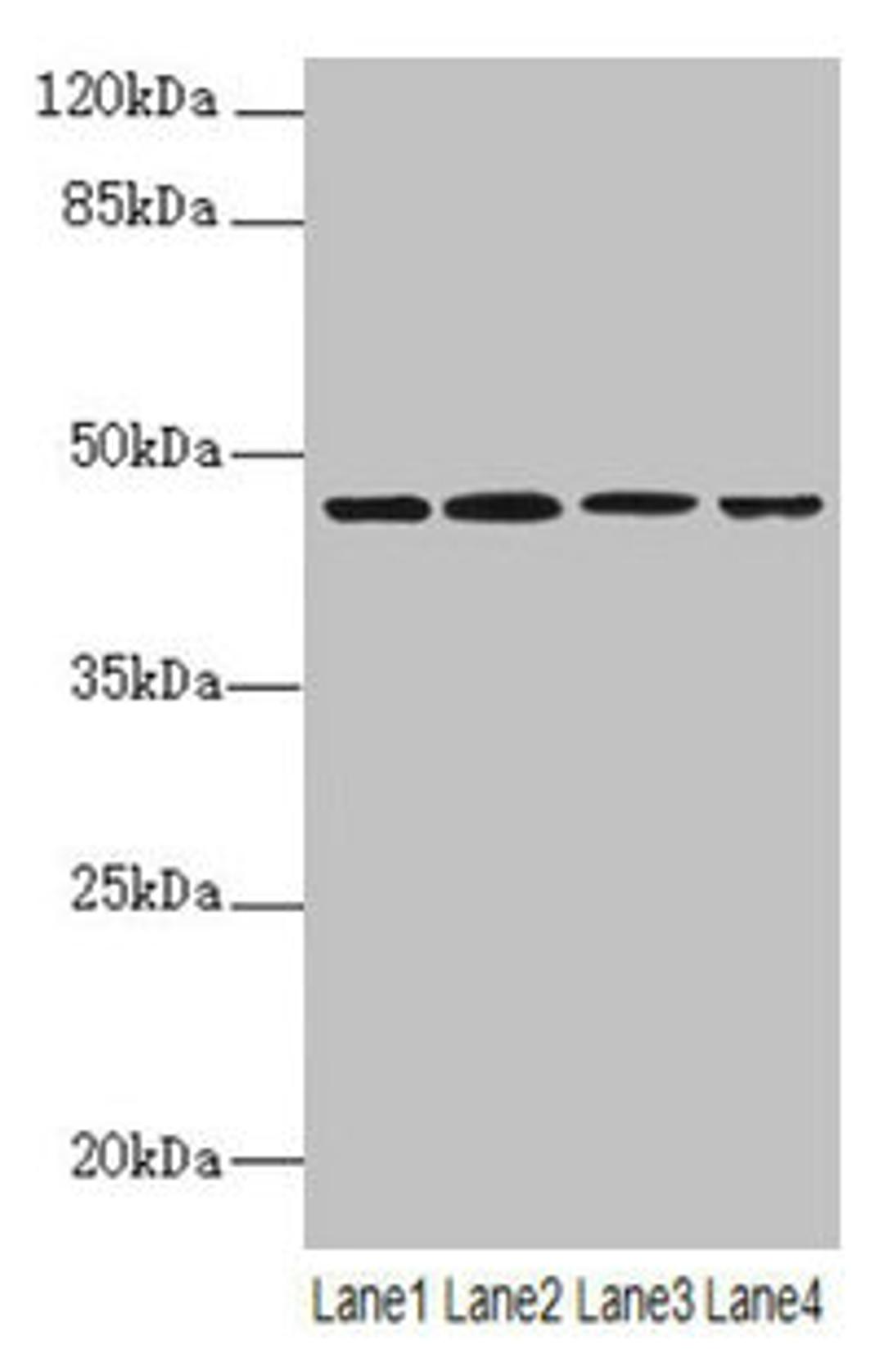 Western blot. All lanes: NAPEPLD antibody at 6µg/ml. Lane 1: Mouse large intestine tissue. Lane 2: Mouse kidney tissue. Lane 3: Mouse stomach tissue. Lane 4: MCF-7 whole cell lysate. Secondary. Goat polyclonal to rabbit IgG at 1/10000 dilution. Predicted band size: 46 kDa. Observed band size: 46 kDa