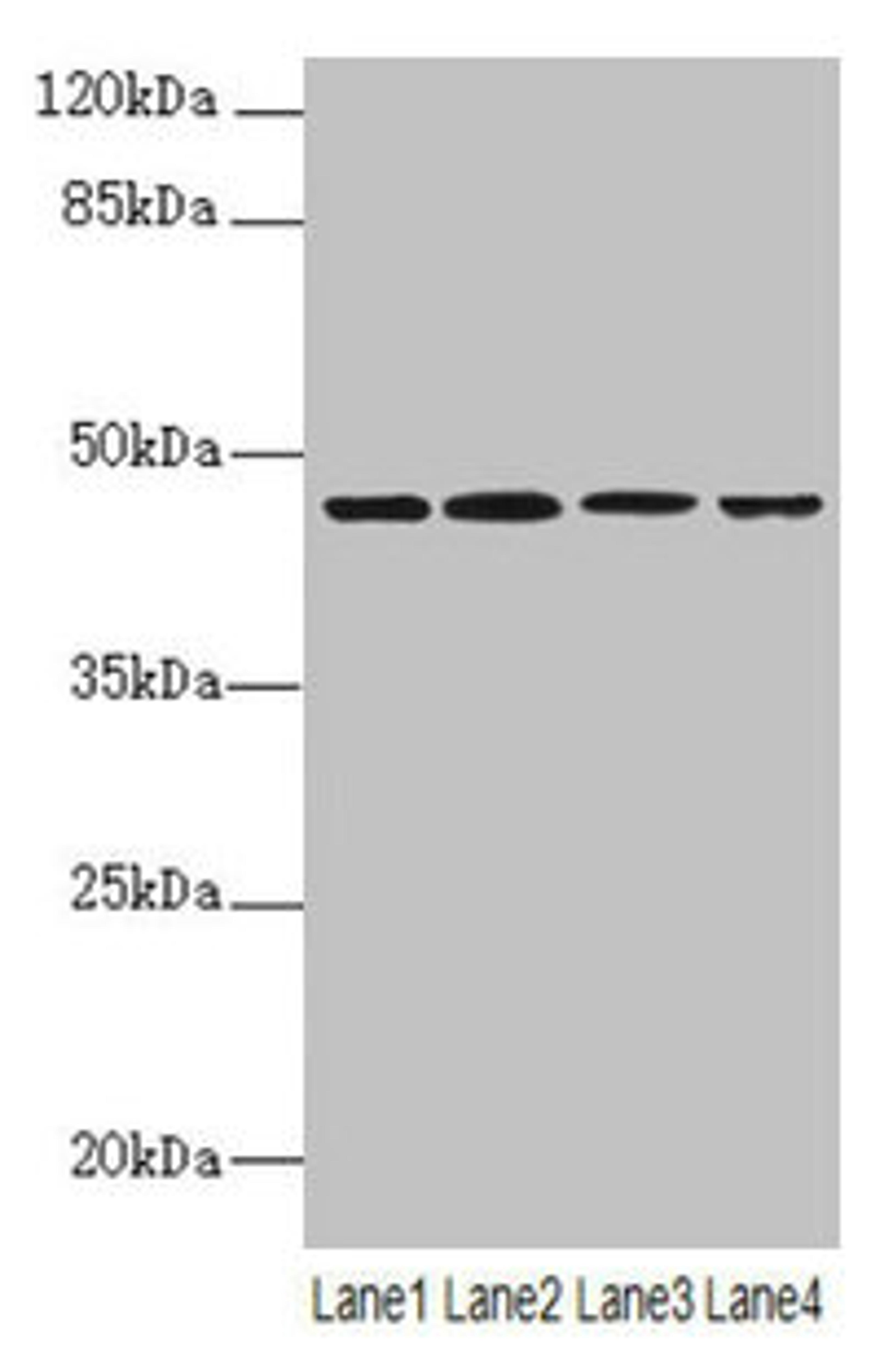 Western blot. All lanes: NAPEPLD antibody at 6µg/ml. Lane 1: Mouse large intestine tissue. Lane 2: Mouse kidney tissue. Lane 3: Mouse stomach tissue. Lane 4: MCF-7 whole cell lysate. Secondary. Goat polyclonal to rabbit IgG at 1/10000 dilution. Predicted band size: 46 kDa. Observed band size: 46 kDa