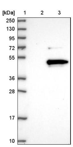 Western Blot: LRRC23 Antibody [NBP1-88962] - Lane 1: Marker [kDa] 250, 130, 95, 72, 55, 36, 28, 17, 10<br/>Lane 2: Negative control (vector only transfected HEK293T lysate)<br/>Lane 3: Over-expression lysate (Co-expressed with a C-terminal myc-DDK tag (~3.1 kDa) in mammalian HEK293T cells, LY404500)