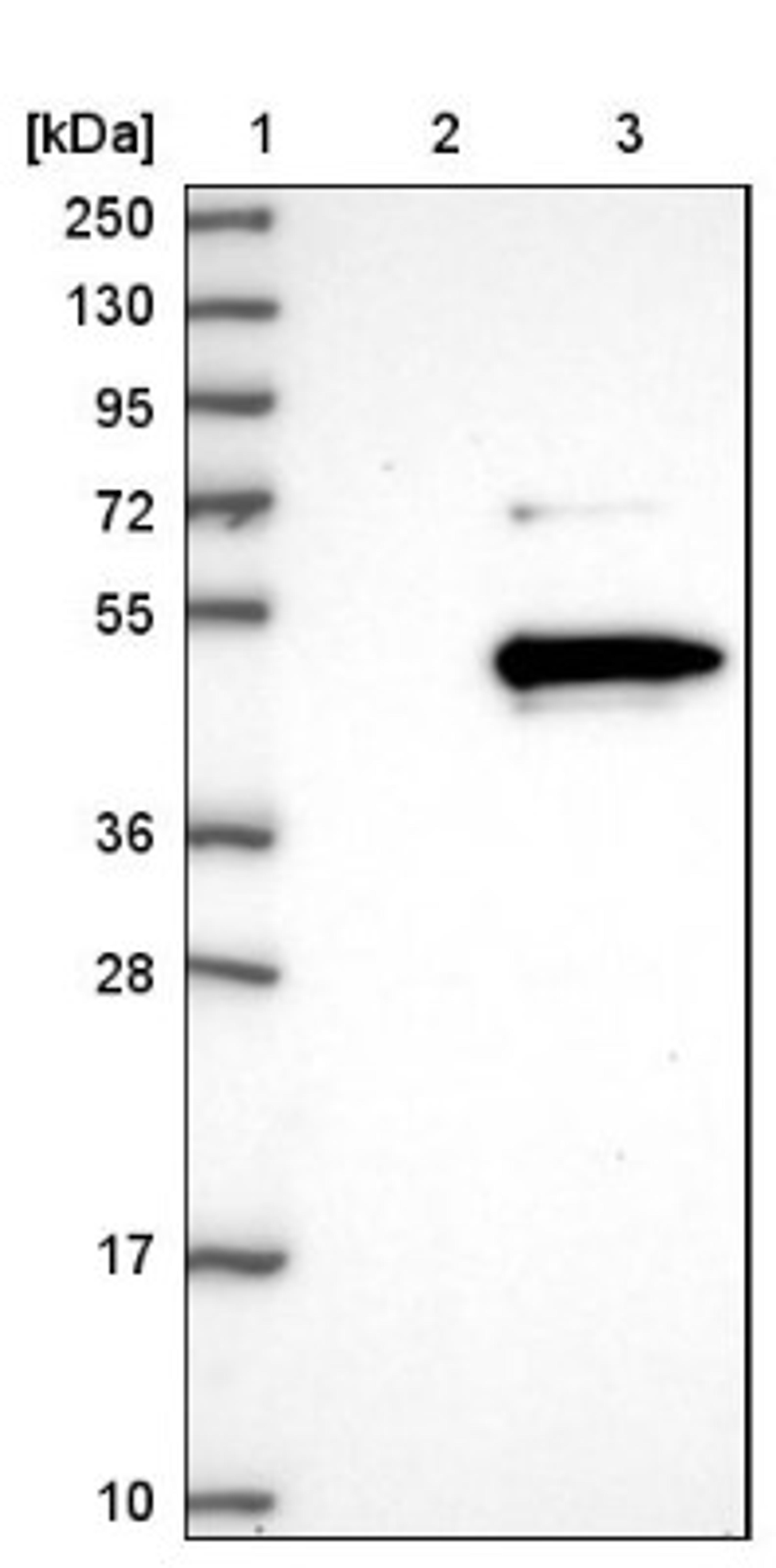 Western Blot: LRRC23 Antibody [NBP1-88962] - Lane 1: Marker [kDa] 250, 130, 95, 72, 55, 36, 28, 17, 10<br/>Lane 2: Negative control (vector only transfected HEK293T lysate)<br/>Lane 3: Over-expression lysate (Co-expressed with a C-terminal myc-DDK tag (~3.1 kDa) in mammalian HEK293T cells, LY404500)