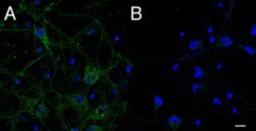 Immunocytochemistry/Immunofluorescence: IFT74 Antibody [NB300-822] - A) (2.5mg/ml) staining of primary rat cortical neurons showed localization of IFT74 to vesicles in the cell body and along the neuronal processes. B) Control. (Data were kindly provided by Dr. Bryan Traynor.)