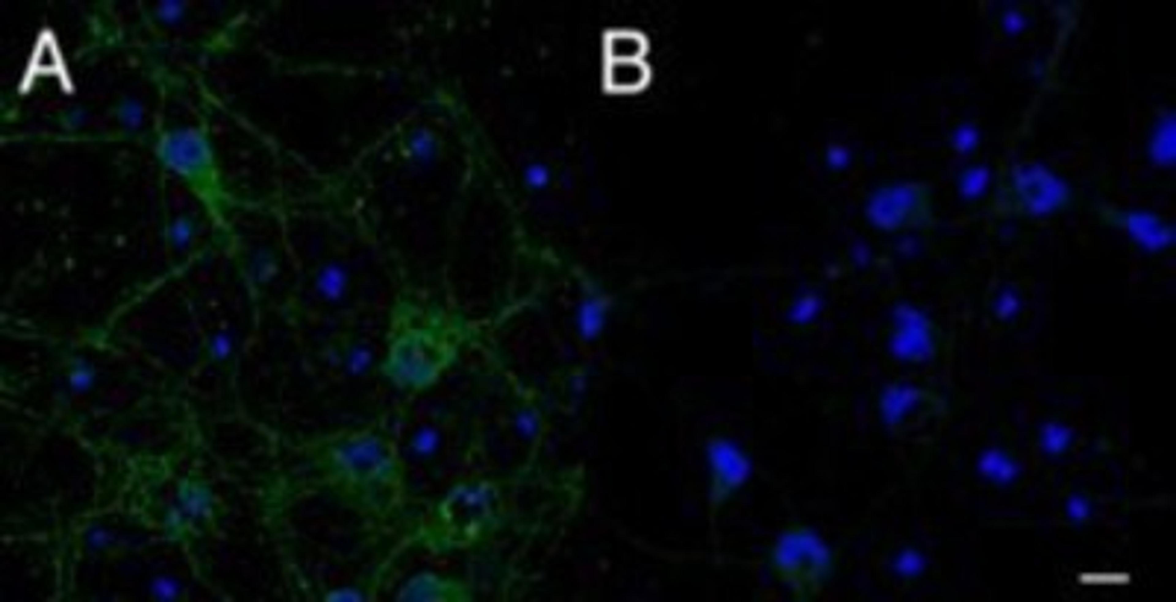 Immunocytochemistry/Immunofluorescence: IFT74 Antibody [NB300-822] - A) (2.5mg/ml) staining of primary rat cortical neurons showed localization of IFT74 to vesicles in the cell body and along the neuronal processes. B) Control. (Data were kindly provided by Dr. Bryan Traynor.)