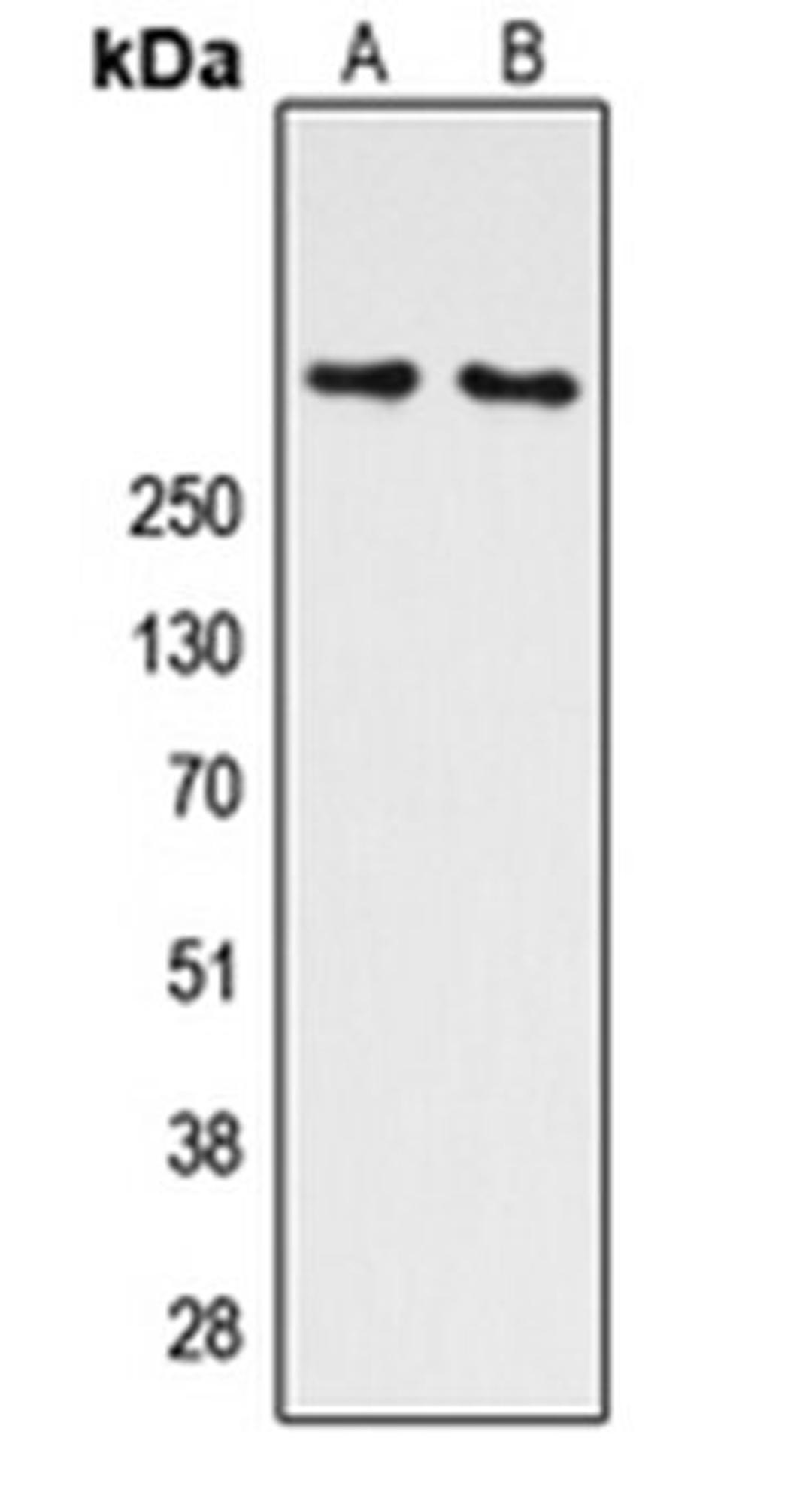 Western blot analysis of K562 (Lane 1), HEK293T UV-treated (Lane 2) whole cell lysates using ATM (phospho-S1981) antibody