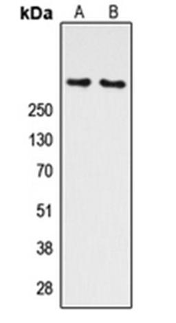 Western blot analysis of K562 (Lane 1), HEK293T UV-treated (Lane 2) whole cell lysates using ATM (phospho-S1981) antibody