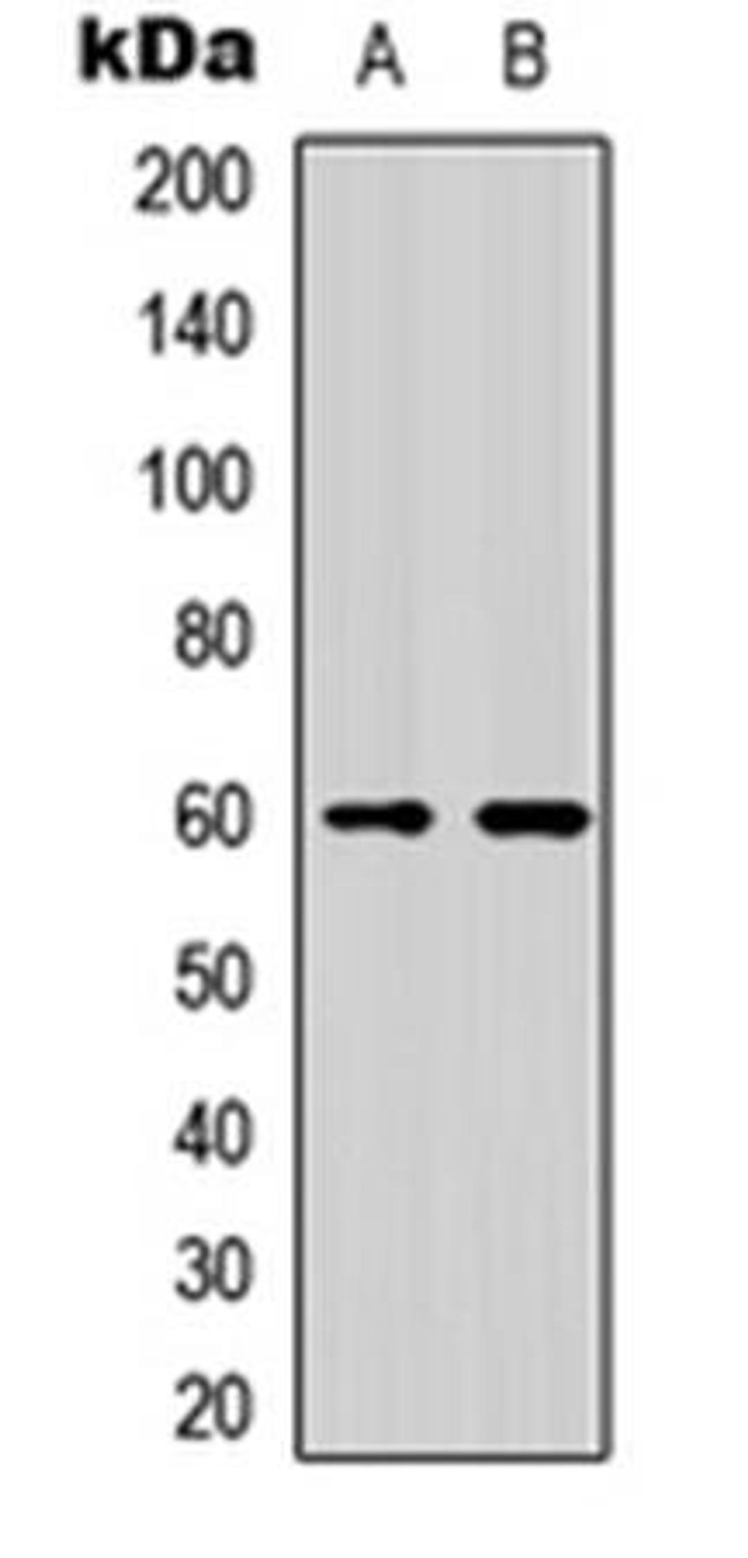 Western blot analysis of HeLa (Lane1), K562 (Lane2) whole cell using NFIL3 antibody