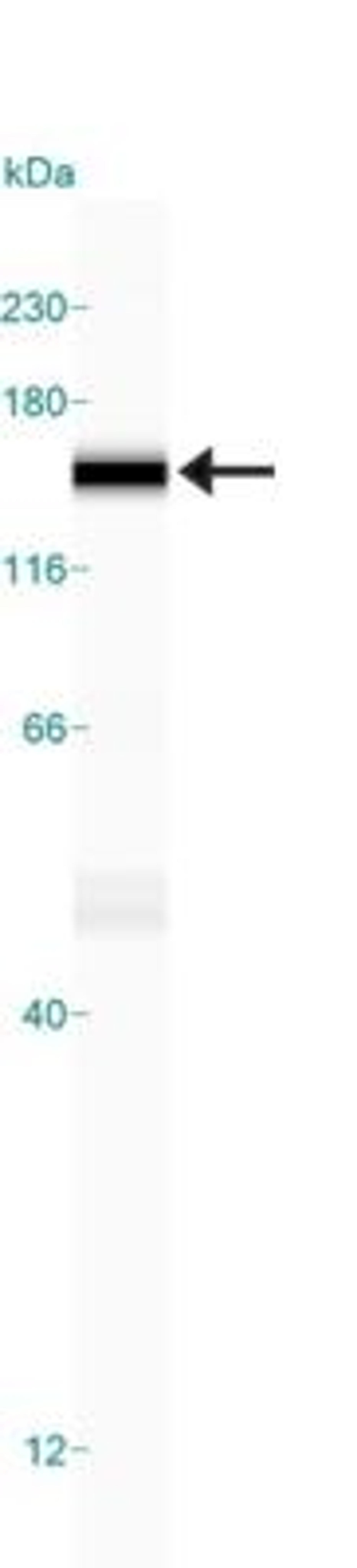 Simple Western: FANCD2 Antibody (FI-17) [NB100-316] - Simple Western lane view shows a specific band for FANCD2 in 1.0 mg/ml of HeLa lysate.  This experiment was performed under reducing conditions using the 12-230 kDa separation system.