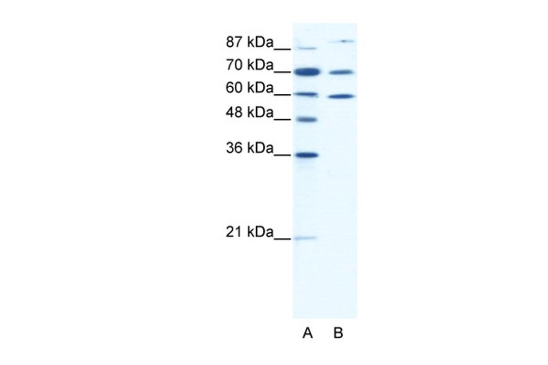 Antibody used in WB on Human HepG2 cells at 0.625 ug/ml.