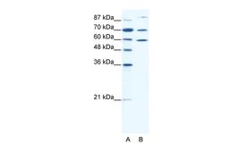 Antibody used in WB on Human HepG2 cells at 0.625 ug/ml.