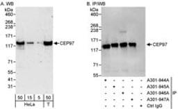 Detection of human CEP97 by western blot and immunoprecipitation.