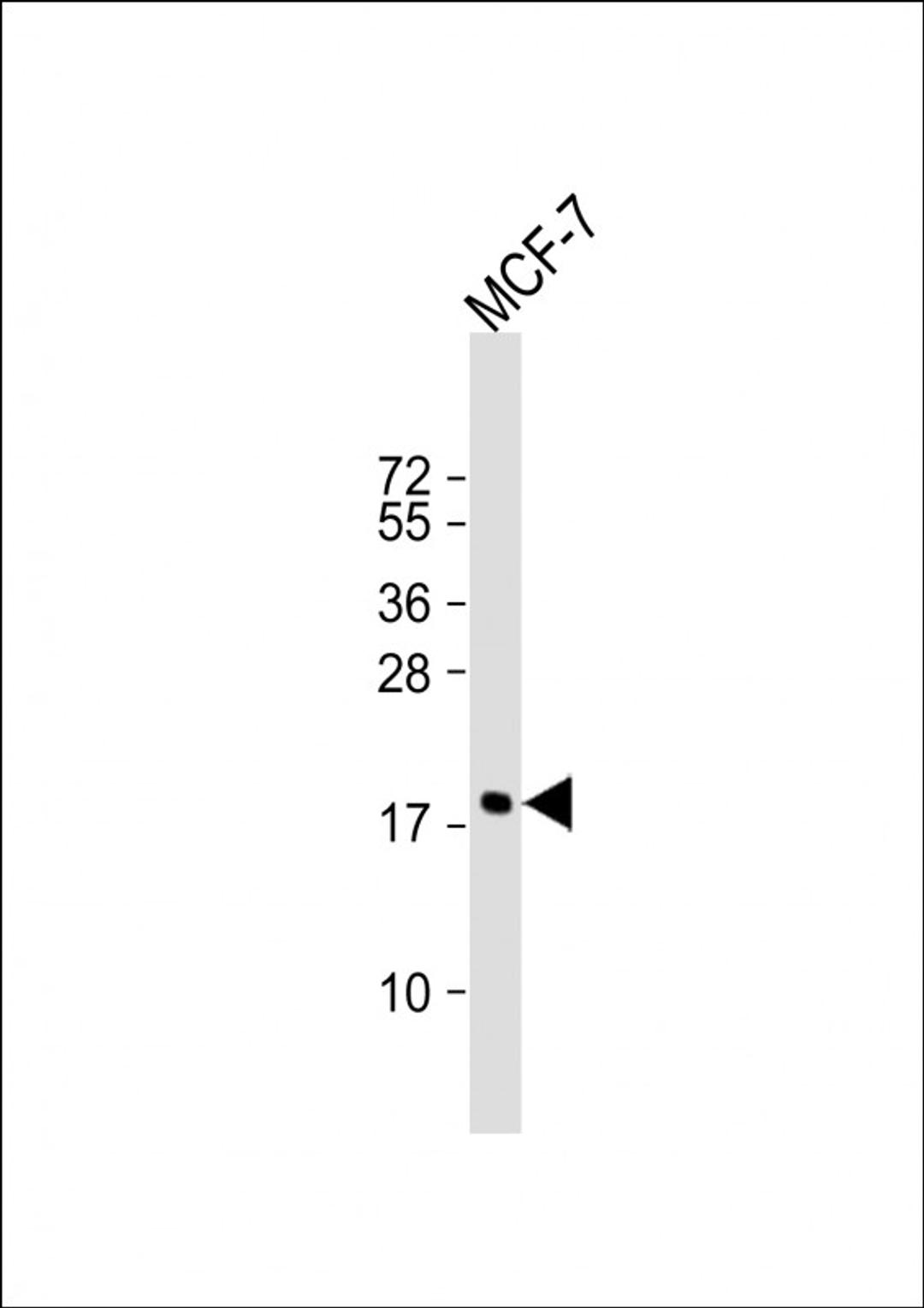 Western Blot at 1:1000 dilution + MCF-7 whole cell lysate Lysates/proteins at 20 ug per lane.