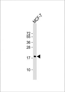 Western Blot at 1:1000 dilution + MCF-7 whole cell lysate Lysates/proteins at 20 ug per lane.