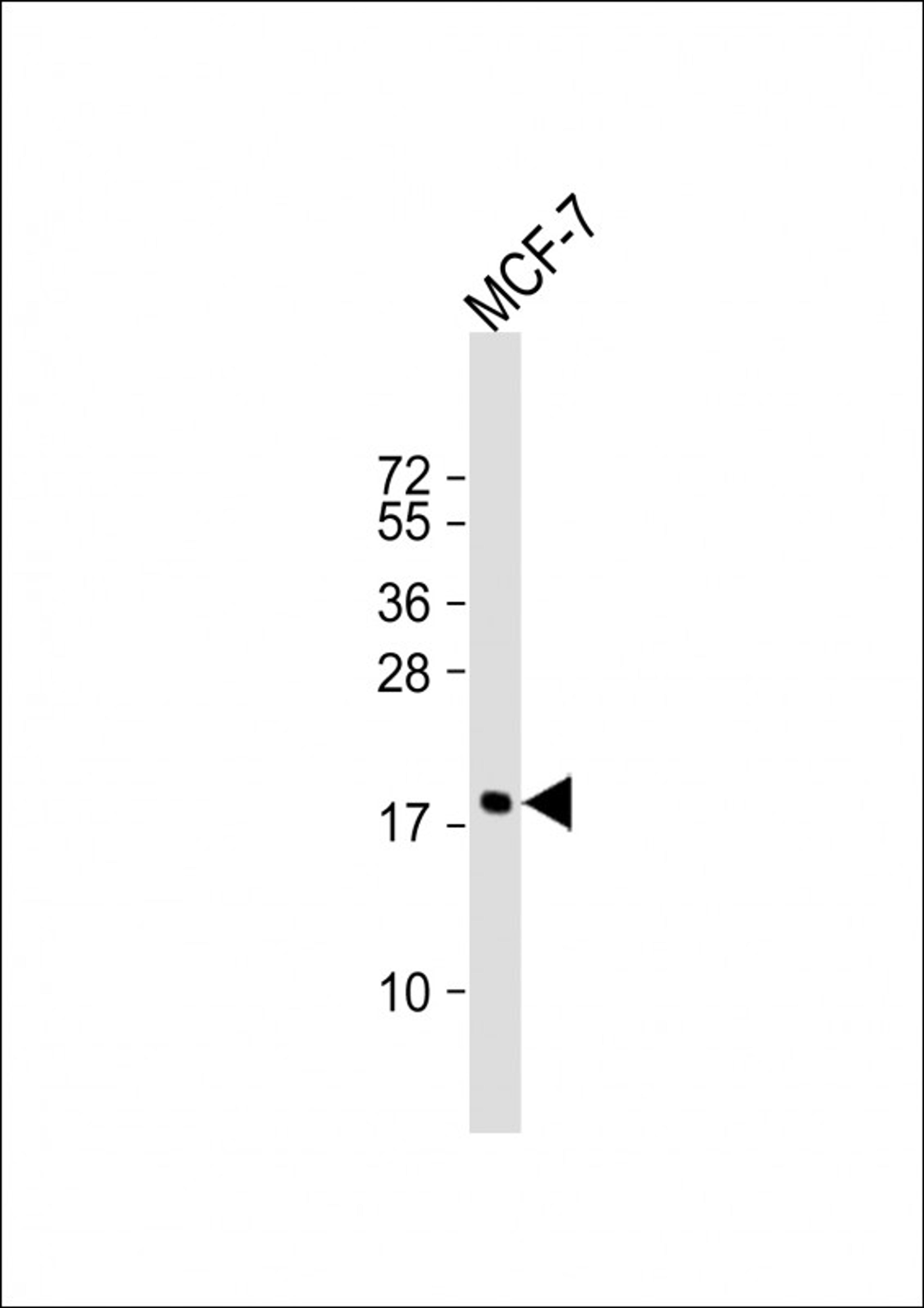 Western Blot at 1:1000 dilution + MCF-7 whole cell lysate Lysates/proteins at 20 ug per lane.