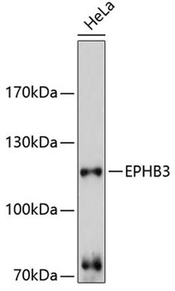 Western blot - EPHB3 antibody (A10214)