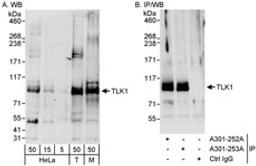 Detection of human and mouse TLK1 by western blot (h & m) and immunoprecipitation (h).