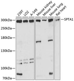 Western blot - SPTA1 antibody (A12355)