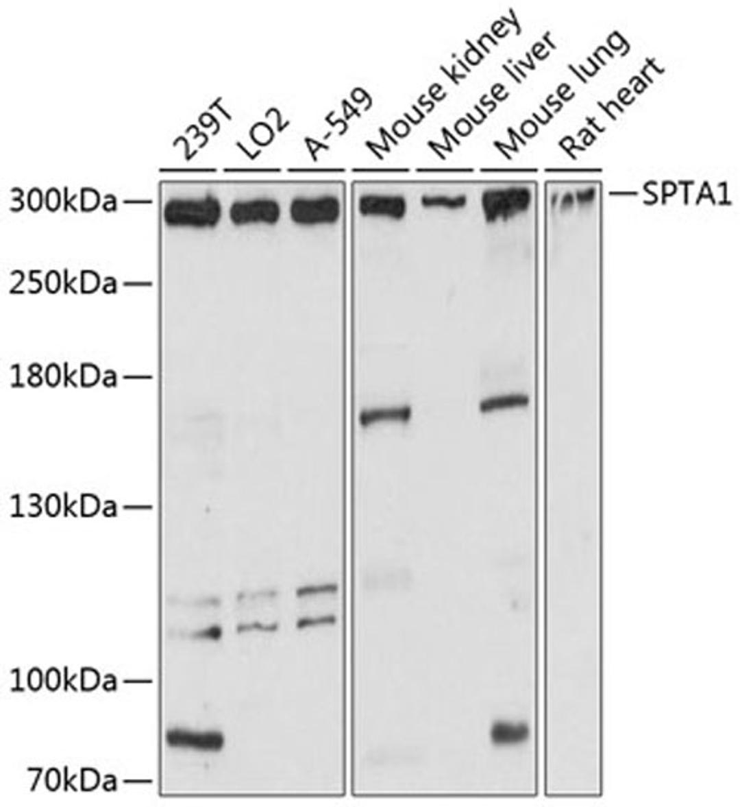 Western blot - SPTA1 antibody (A12355)