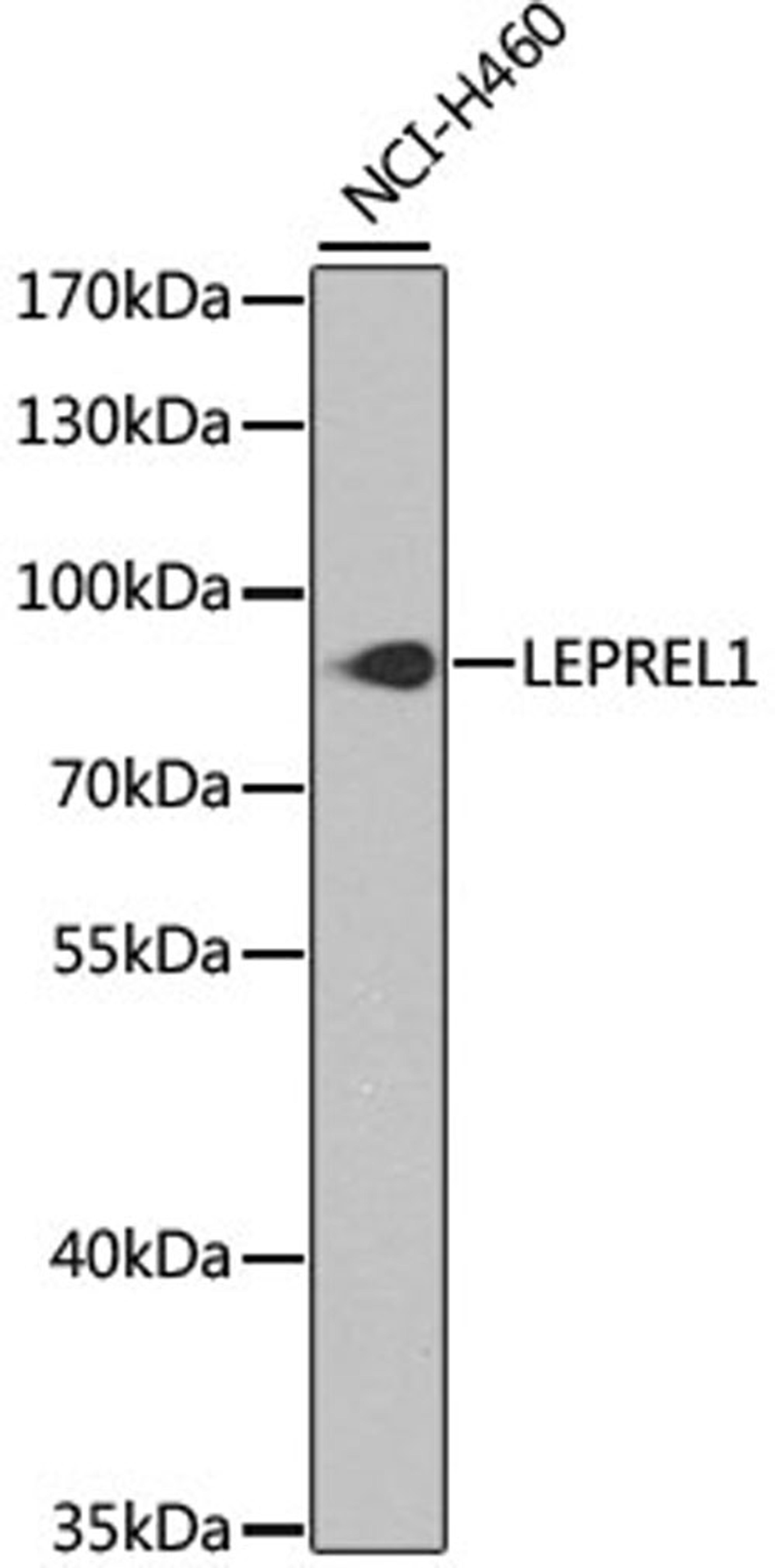 Western blot - LEPREL1 antibody (A8068)