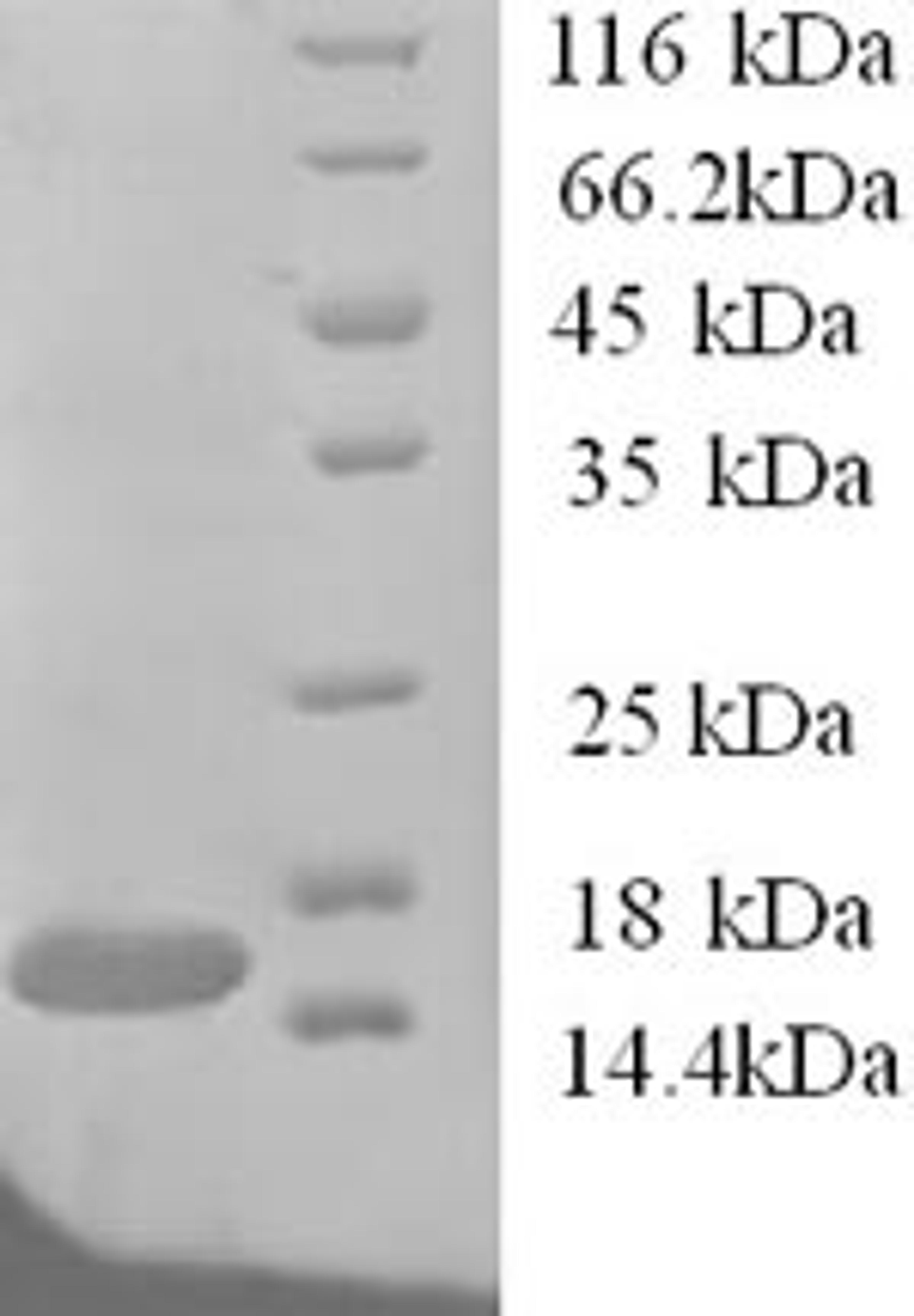 (Tris-Glycine gel) Discontinuous SDS-PAGE (reduced) with 5% enrichment gel and 15% separation gel.
