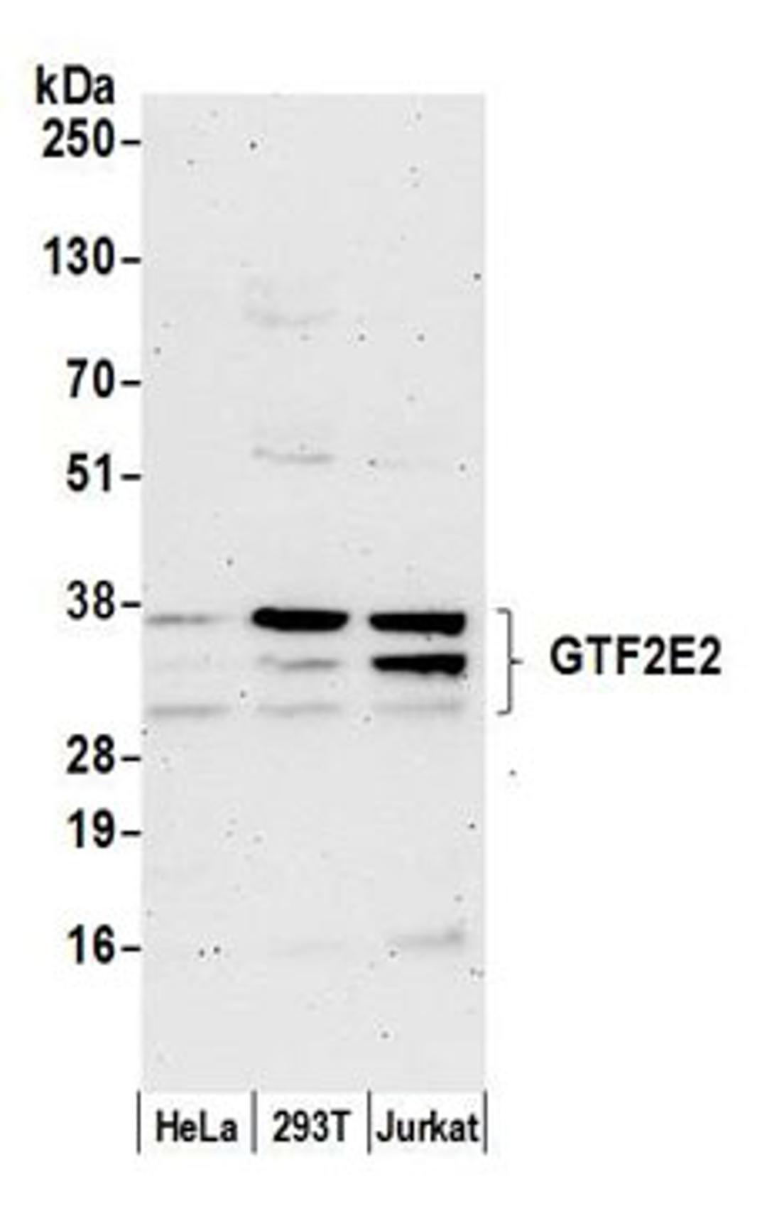 Detection of human GTF2E2 by western blot.