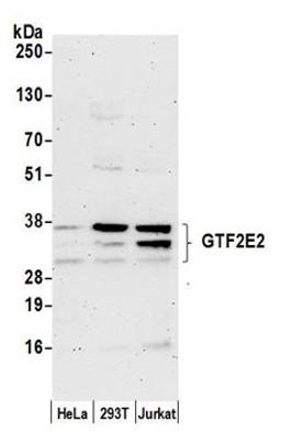 Detection of human GTF2E2 by western blot.