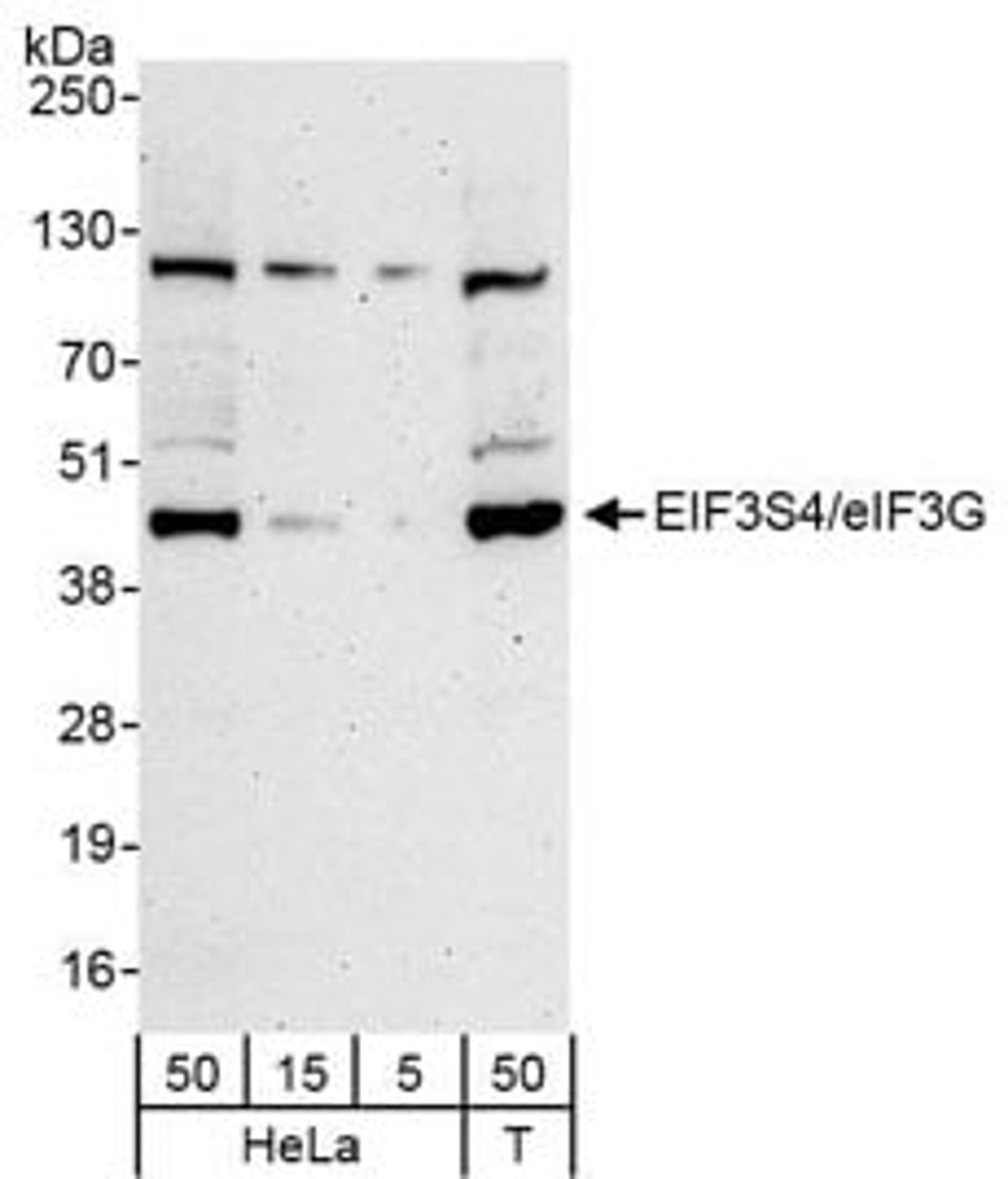 Detection of human eIF3G/EIF3S4 by western blot.