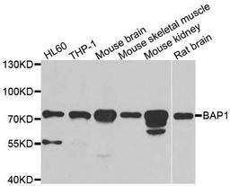 Western blot analysis of extracts of various cell lines using BAP1 antibody