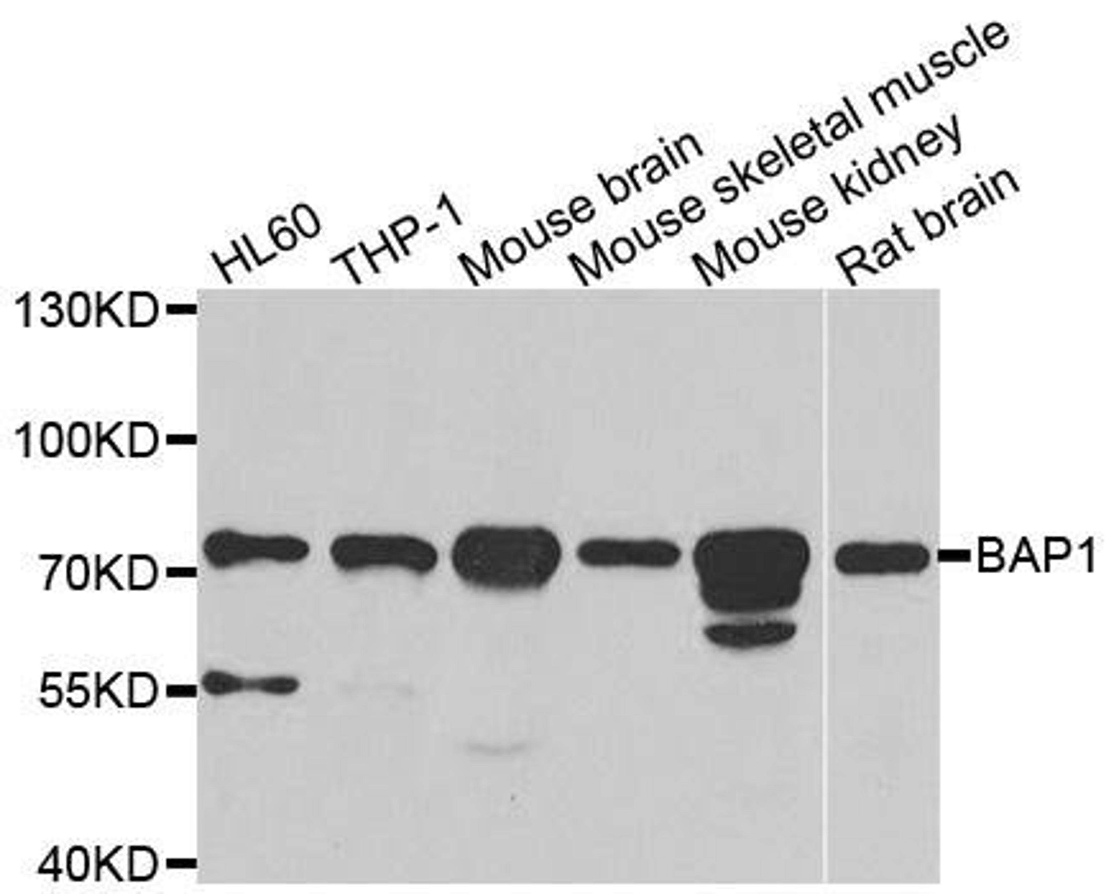 Western blot analysis of extracts of various cell lines using BAP1 antibody