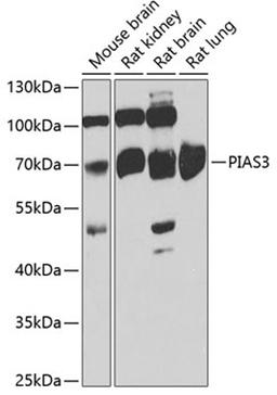 Western blot - PIAS3 antibody (A7060)