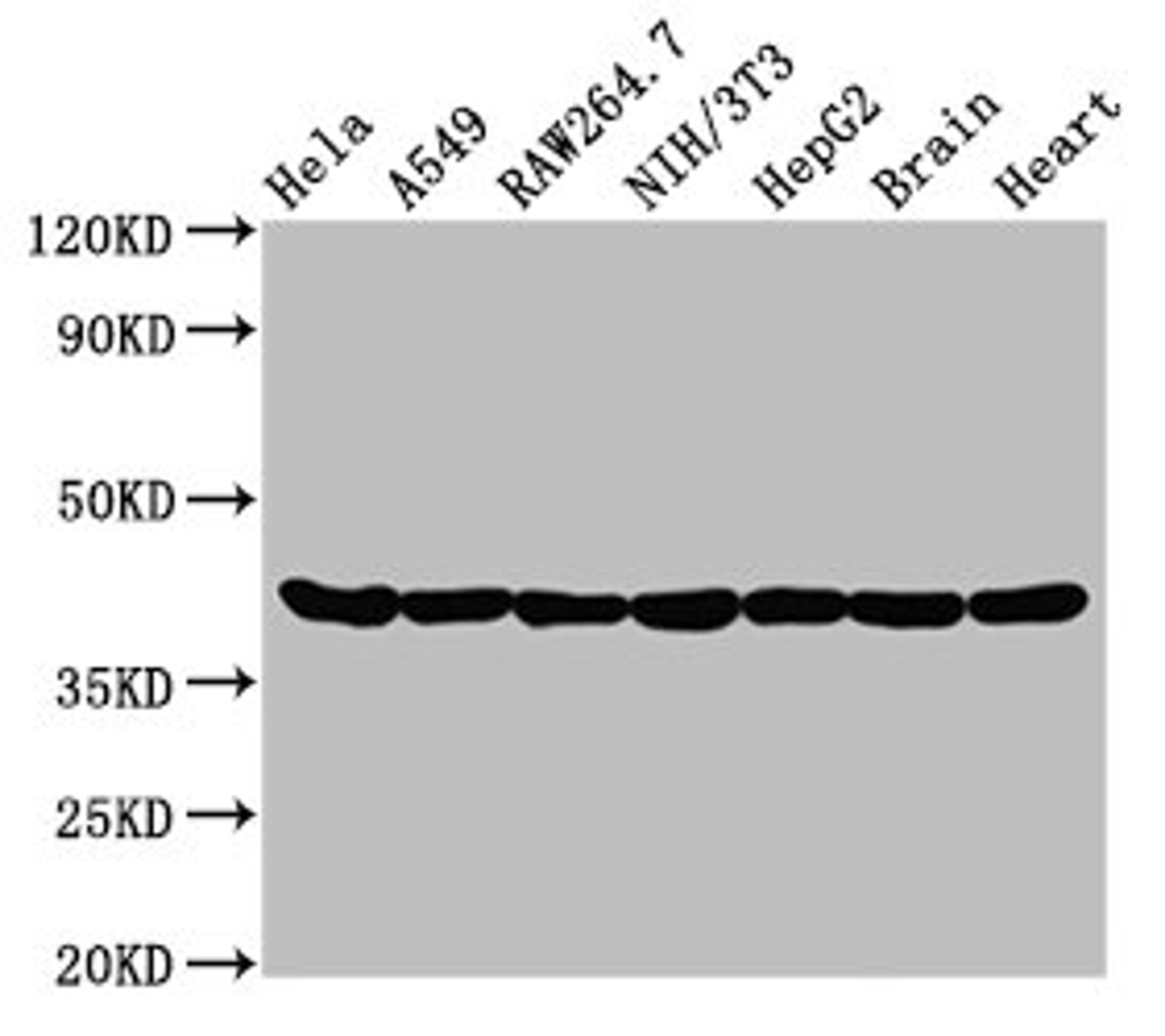 Western Blot. Positive WB detected in: Hela whole cell lysate, A549 whole cell lysate, Raw264.7 whole cell lysate, NIH/3T3 whole cell lysate, HepG2 whole cell lysate, Rat brain tissue, Rat heart tissue. All lanes: Actin antibody at 0.95μg/ml. Secondary. Goat polyclonal to rabbit IgG at 1/50000 dilution. Predicted band size: 42 KDa. Observed band size: 42 KDa. 