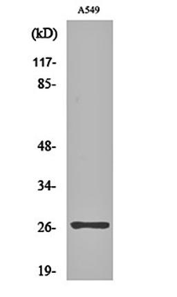 Western blot analysis of A549 cell lysates using NET-5 antibody